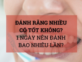 Đánh răng nhiều có tốt không? 1 ngày nên đánh bao nhiêu lần?