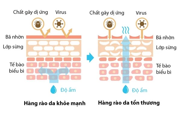 Chức năng của hàng rào bảo vệ da